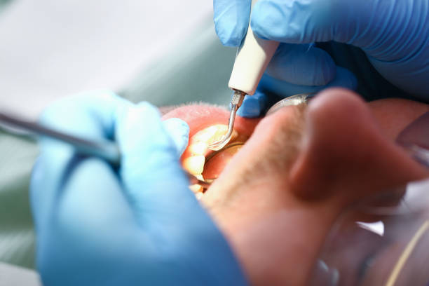 Best Emergency Dentist for Knocked-Out Tooth in Borrego Springs, CA