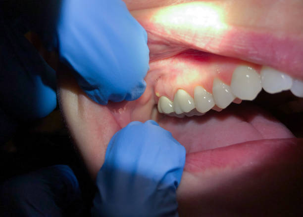 Best Pediatric Emergency Dentist in Borrego Springs, CA