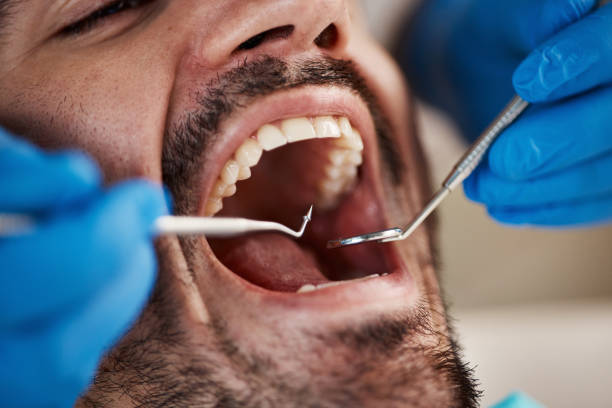Best Emergency Dental Services for Seniors in Borrego Springs, CA